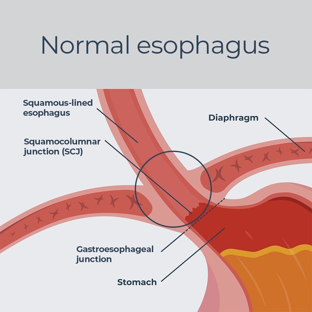 tc-normal-esophagus-illustration_r3 tc-normal-esophagus-illustration_r3